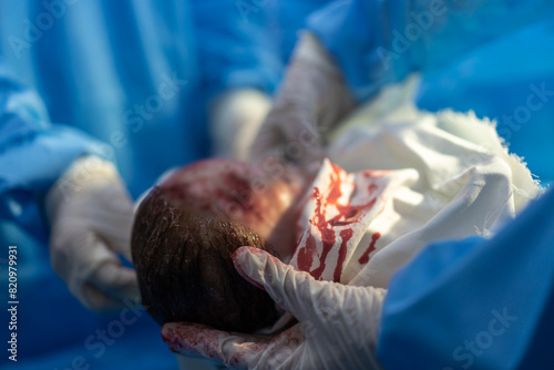 Professional anesthesiologist doctor medical team and assistant is performing baby cesarean section and hold the baby giving birth with surgery equipment in modern hospital operation room