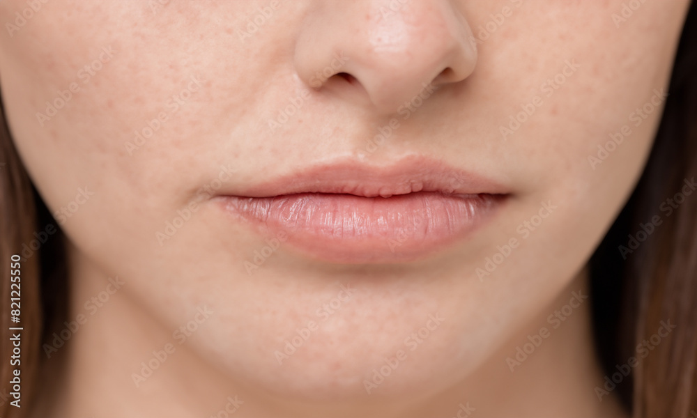 Close up view of caucasian woman's face, nose, lips, cheeks. Unrecognizable person. Beaty industry, skincare concept, Close up view of caucasian woman's face, nose, lips, cheeks. Unrecognizable person. Beaty industry, skincare concept,
