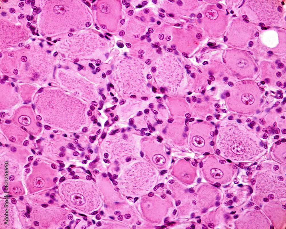 Dorsal root ganglion neurons Dorsal root ganglion neurons