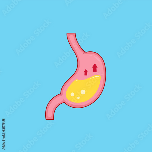 rising stomach acid cartoon vector illustration, acid reflux disease illustration