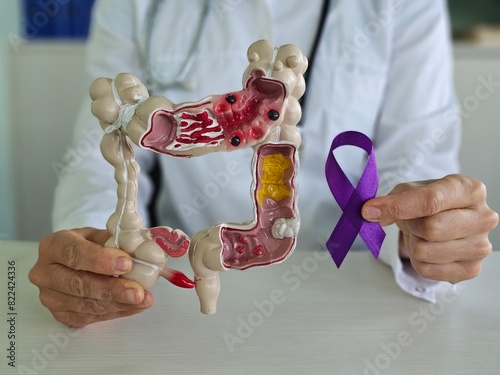 Doctor holding blue purple ribbon with human colon anatomy model