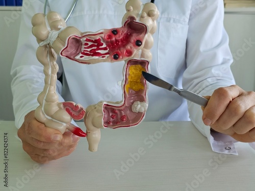 Doctor holding a scalpel on intestinal anatomy