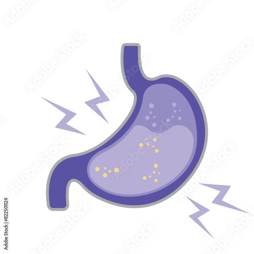 Gastroesophageal reflux disease concept. Human stomach full of gastric acid, cut view. Vector illustration in flat style.