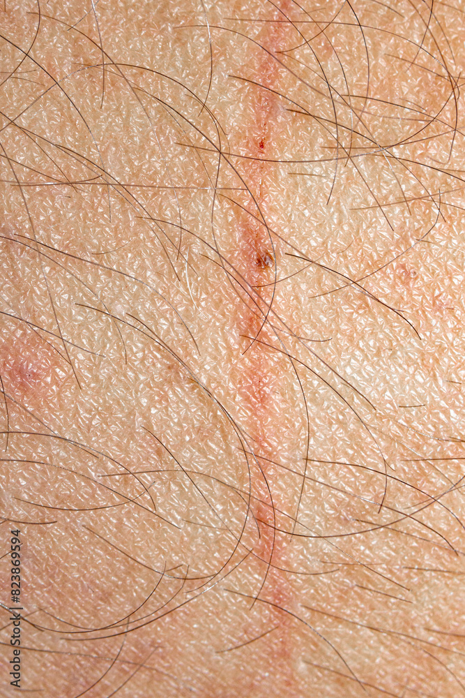A Scratch On Real Imperfect Skin A Scratch On Real Imperfect Skin