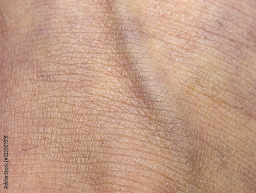 Abstract Vein Body Skin Texture 