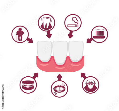 Causes of gingival recession. Vector illustration.