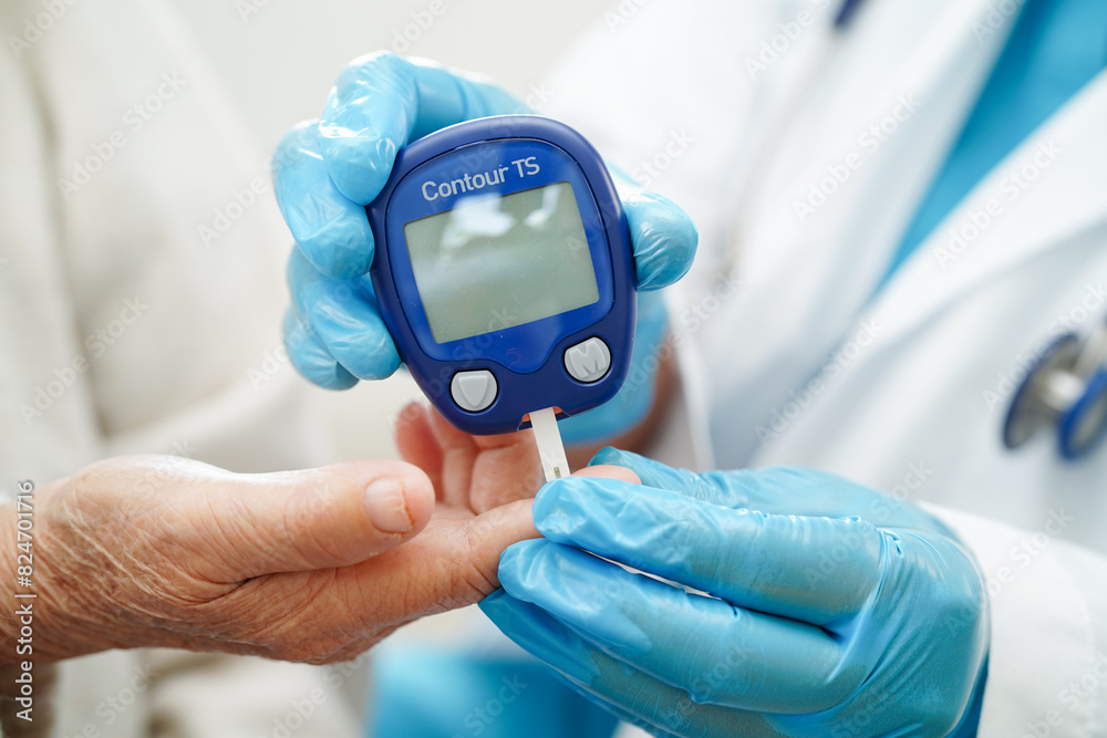 Asian doctor using digital glucose meter for check sample blood sugar level to treatment diabetes. Asian doctor using digital glucose meter for check sample blood sugar level to treatment diabetes.