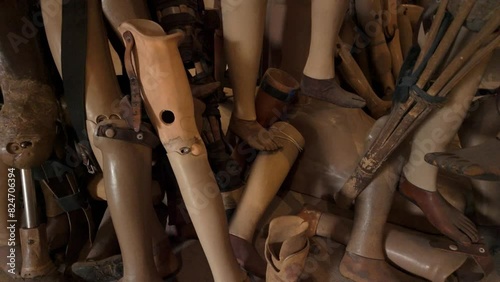 Old Prosthetic Limbs Display at War Museum