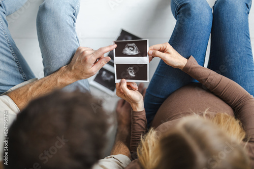 Couple expecting a baby looking at pregnancy ultrasound scan 
