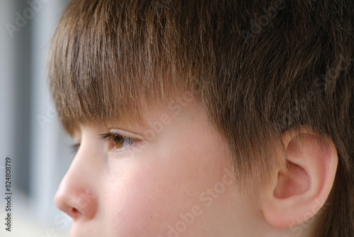 close up part child face, boy 8 years old, human eye looking to side, vision examination, diagnosis, treatment ophthalmic diseases, eyelids, emotional development children