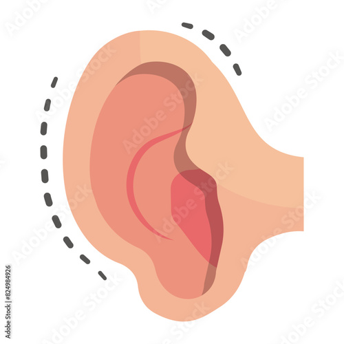 Ear correction surgery or Otoplasty concept, Constricted ears vector flat design, plastic surgeon Symbol,  body contouring Sign, Beauty treatment stock illustration