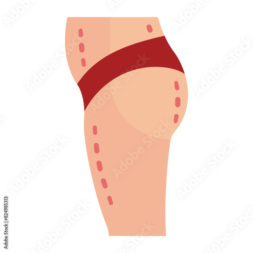Thighplasty or Legs reshaping therapy concept, Human Body Lower Side View vector flat design, plastic surgeon Symbol,  body contouring Sign, Beauty treatment stock illustration