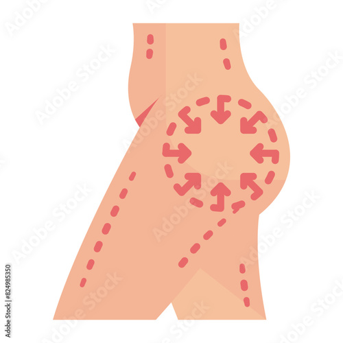 Prosthetic Leg implant Surgery concept, artificial limb vector flat design, plastic surgeon Symbol,  body contouring Sign, Beauty treatment stock illustration