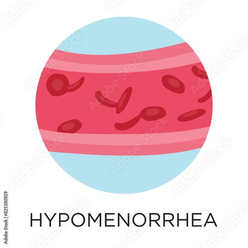 Hypomenorrhea (light blood flow) flat style vector illustration