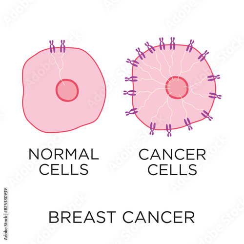 Breast cancer normal cells versus cancer cells comparison flat style vector illustration