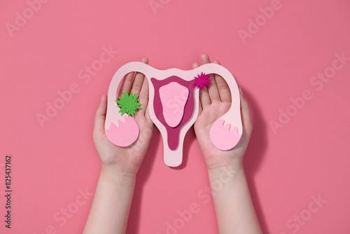 Awareness of uterus illness such as endometriosis, PCOS, STDs, HPV photo