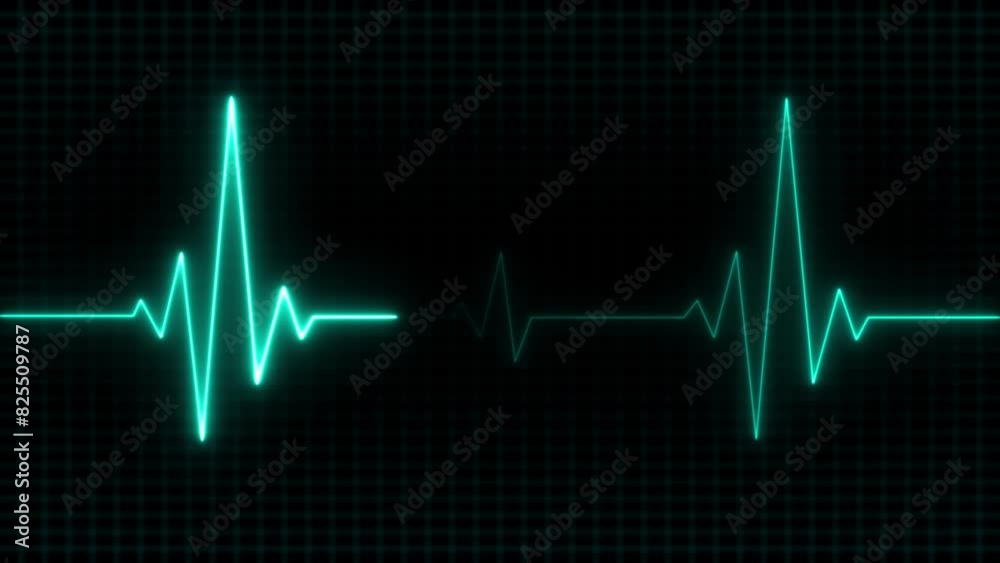 Heart Rate Monitor Electrocardiogram Ekg Or Ecg Looping Background