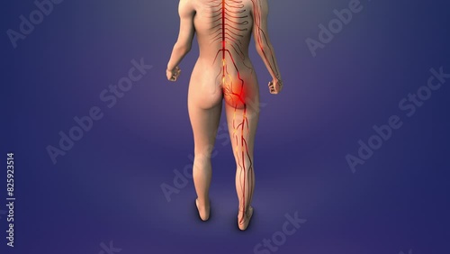 Trigger point for sciatica in human glutes photo