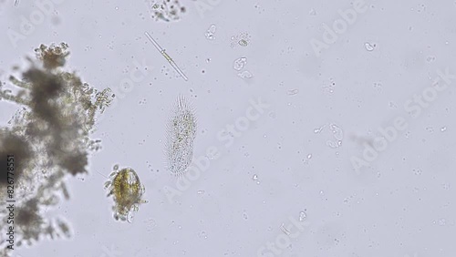 ciliates stylonychia (ciliated protozoan) from a river under the microscope - light microscope x200 magnification photo