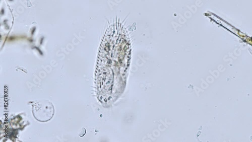 ciliates stylonychia (ciliated protozoan) from a river under the microscope - light microscope x400 magnification photo