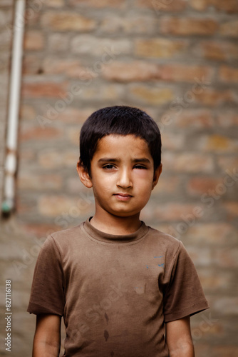 Portrait of a poor staring hungry orphan boy in a refugee camp with a sad expression on his face and his eyes are full of pain