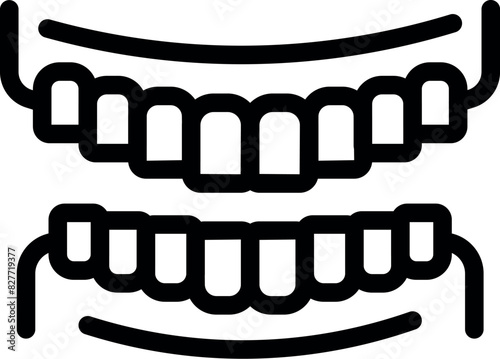 Black and white vector icon of upper and lower teeth with braces, dental orthodontic symbol