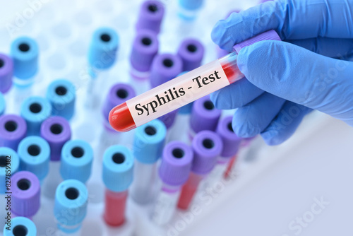 Doctor holding a test blood sample tube with Syphilis test on the background of medical test tubes with analyzes.