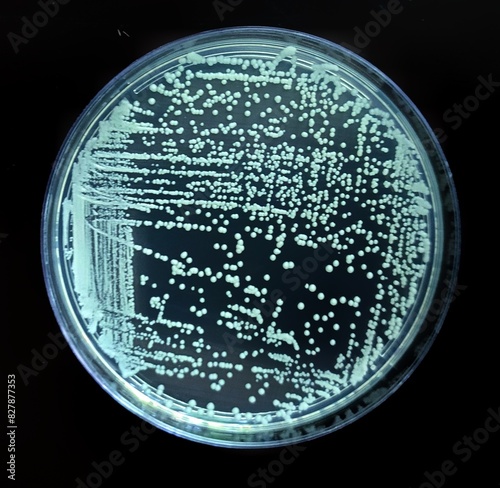 White round colonies of yeast on a Petri dish. An exhaustive touch to check the purity of the culture. Routine microbiological work