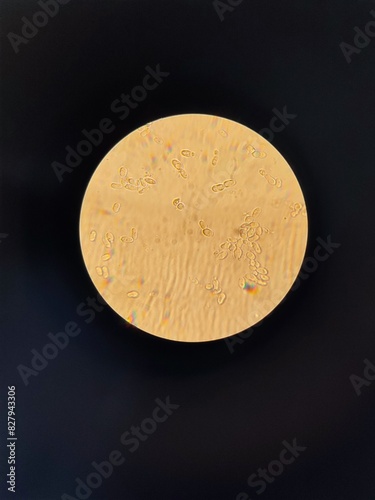 Live preparation of yeast under a light immersion microscope