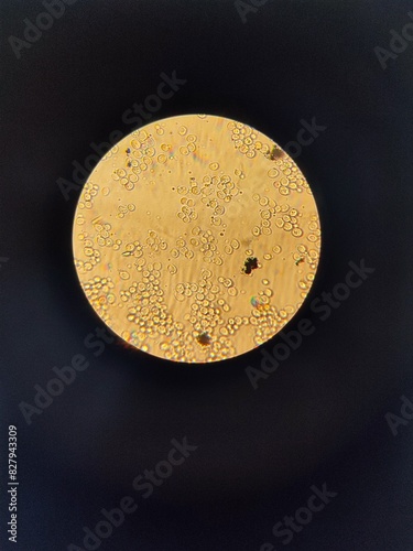 Live preparation of yeast under a light immersion microscope