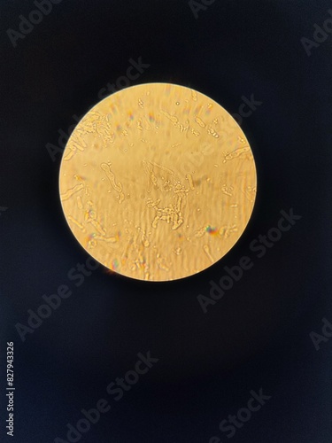 Live preparation of yeast under a light immersion microscope