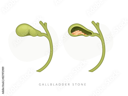 Gall Bladder - Liver Icon stock illustration