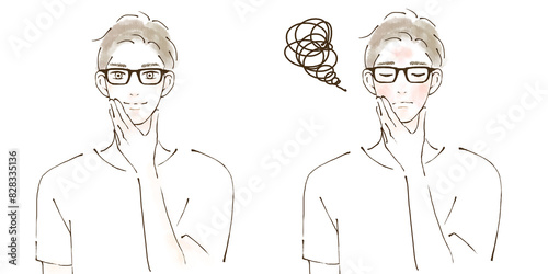 Obraz na płótnie 肌荒れ改善 before after男性のイラストセット アレルギー メガネ w salonie