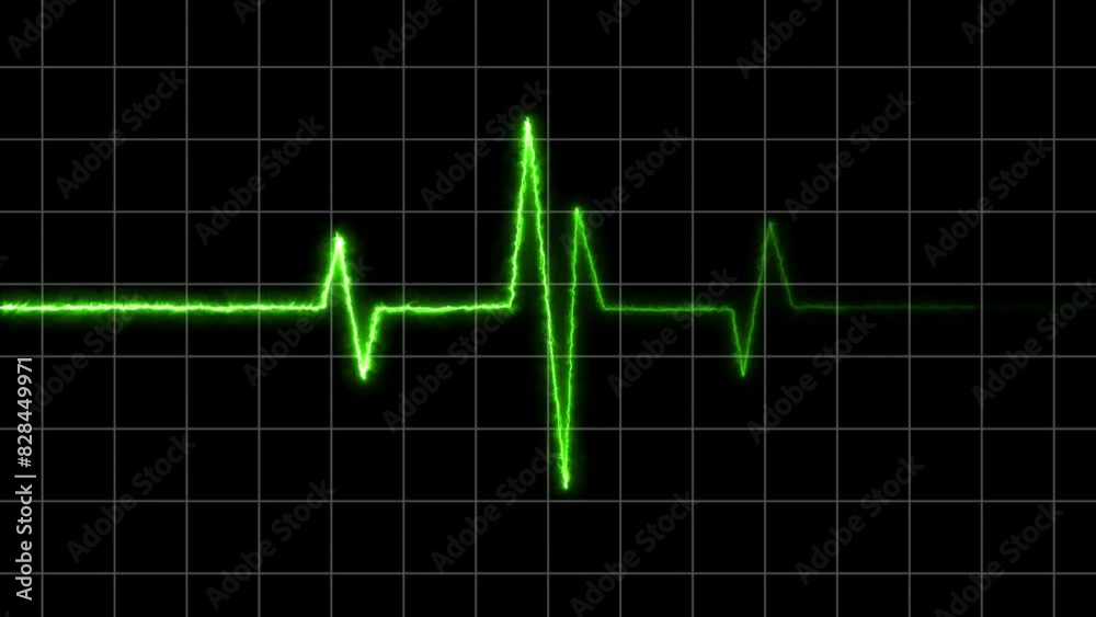 Heart beat electric neon line turquoise color animation. Black background neon light heartbeat display 4k video. Heart beat electric neon line turquoise color animation. Black background neon light heartbeat display 4k video.