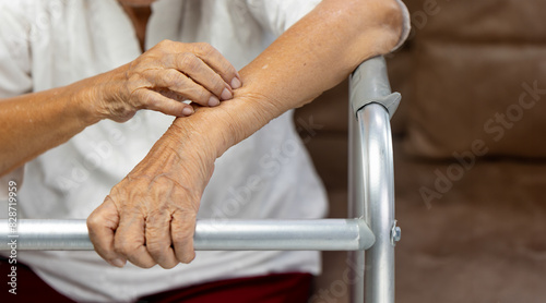 фотографія Elderly woman itchy and scratching arm because dry skin.