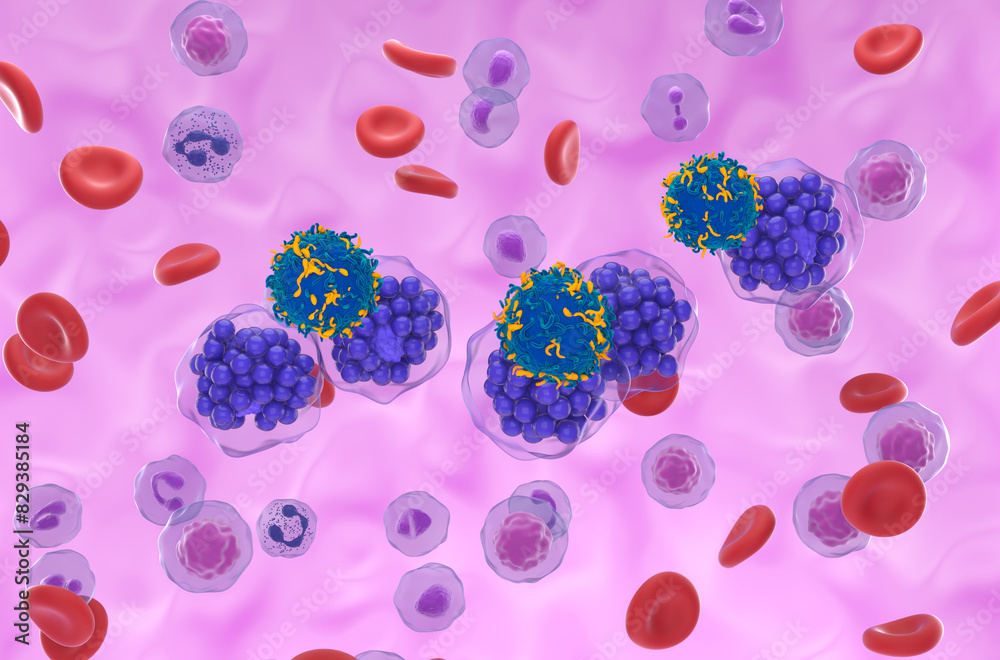 CAR T cell therapy in Diffuse large B-cell lymphoma (DLBCL) - isometric ...
