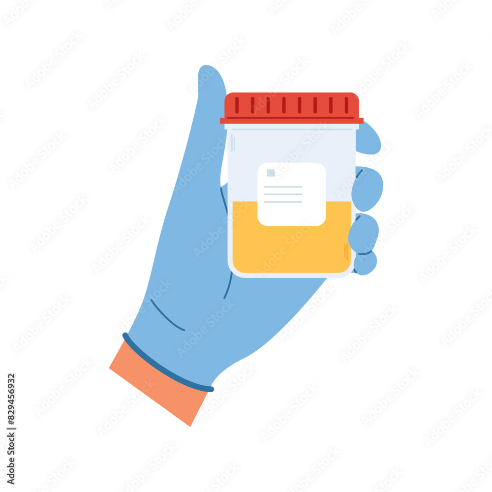 Medical sample in a plastic tube. Laboratory container with urine for diagnostic