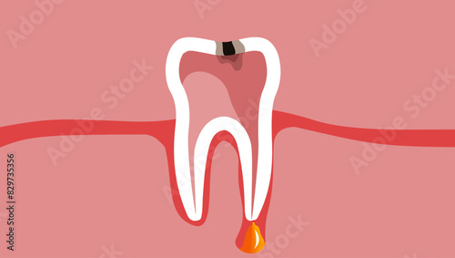 periodontitis emblem, flat color illustration