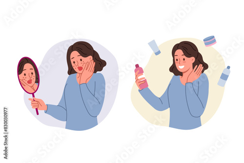 Teenage girl with pimples on face holds mirror and cream to get rid of traces of hormonal explosion. Puberty in young woman caused appearance of rashes or pimples and freckles on skin