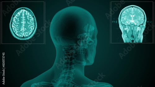 Magnetic resonance scan of the head of a man with visible paranasal sinuses. Anatomically correct 3d animation on dark background photo
