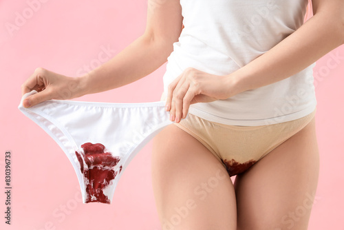Menstruating woman in stain...