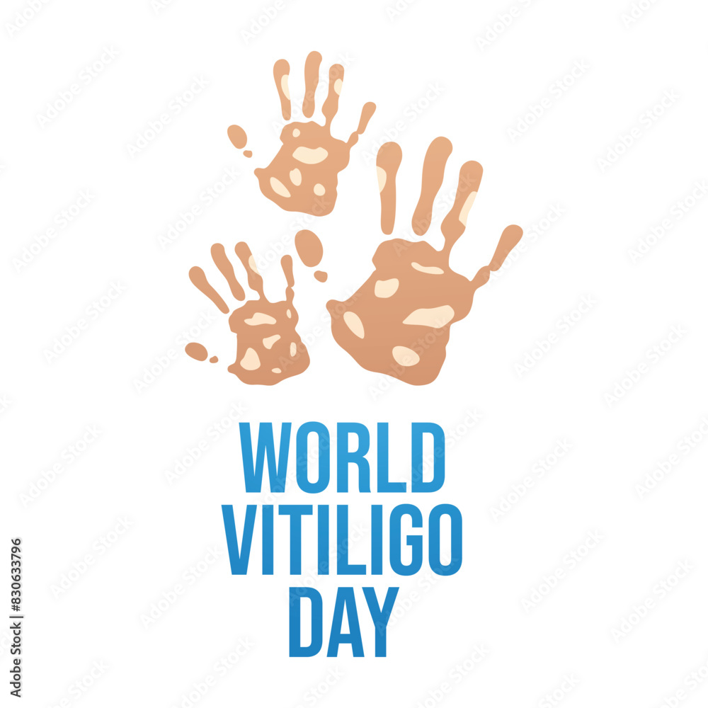 World Vitiligo Day vector design template good for celebration usage. virtiligo image. flat design. eps 10. World Vitiligo Day vector design template good for celebration usage. virtiligo image. flat design. eps 10.
