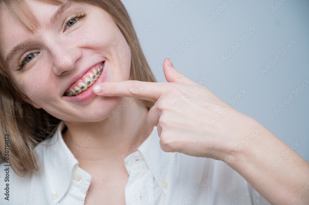A beautiful red-haired girl smiles and points to the braces. Young woman corrects bite with orthodontic appliance A beautiful red-haired girl smiles and points to the braces. Young woman corrects bite with orthodontic appliance