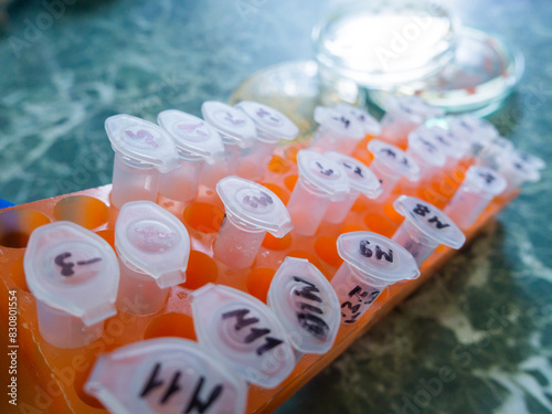 Lots of small Eppendorfs in a pencil case, a set of test tubes for experiments.