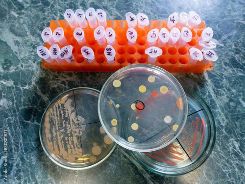 Petri dishes with colonies of bacteria and a pencil case with Eppendorfs nearby.