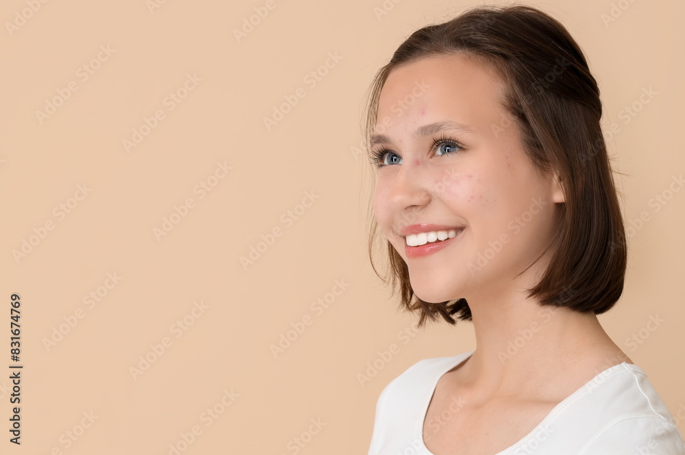 Beautiful young happy woman with acne problem on beige background Beautiful young happy woman with acne problem on beige background
