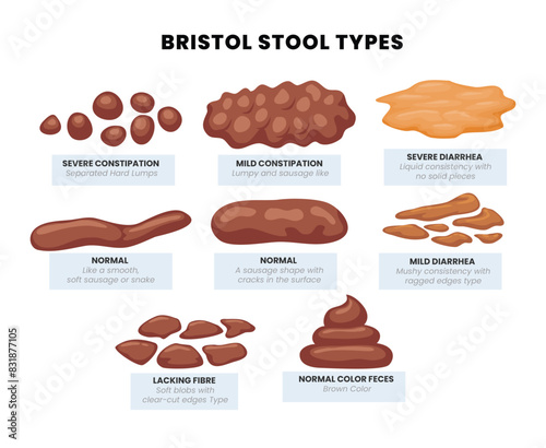 Set of various types human feces - constipation, normal and diarrhea. Bristol stool set with different types of poo, Excrement at health stomach and diseases of digestion. vector illustration. photo