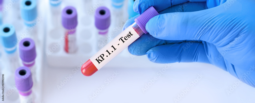 Naklejka premium Doctor holding a test blood sample tube for the detection of the virus KP.1.1 on the background of medical test tubes. KP.1.1 , one of the FliRT variants. 