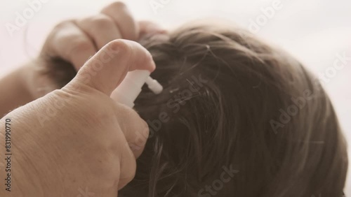 Close-up child's head, Mother's hands applying lice and nit treatment in hair, treating with medication, regular hygiene and pest control, Pediculosis photo
