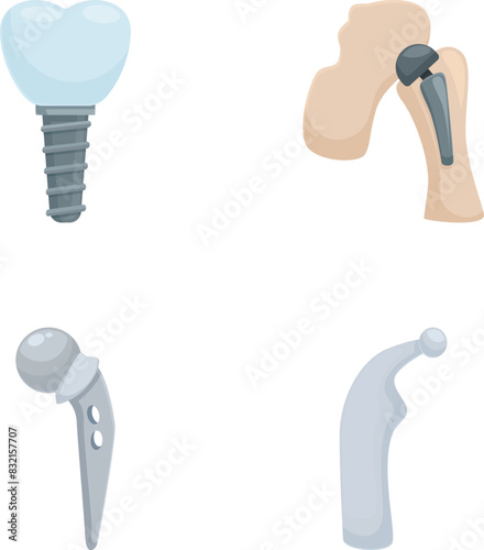 Vector illustration of different medical implants for dentistry and orthopedic surgery